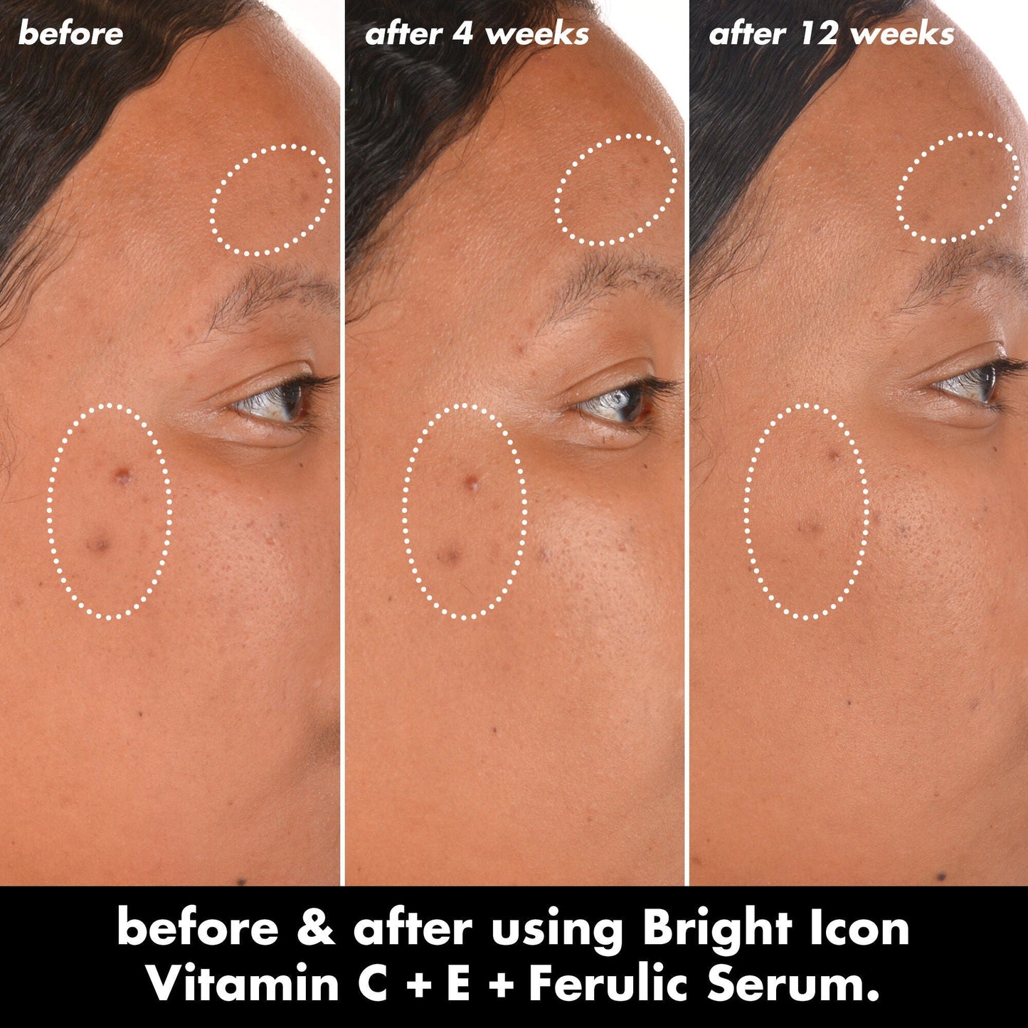 bright-icon-vitamin-c-e-ferulic-serum-r0 0226_EDU_BrightIconVitC_BA_Chanel_TRIPTYCH_c58f2fc8-209d-414f-9ba3-666a07a94887.jpg