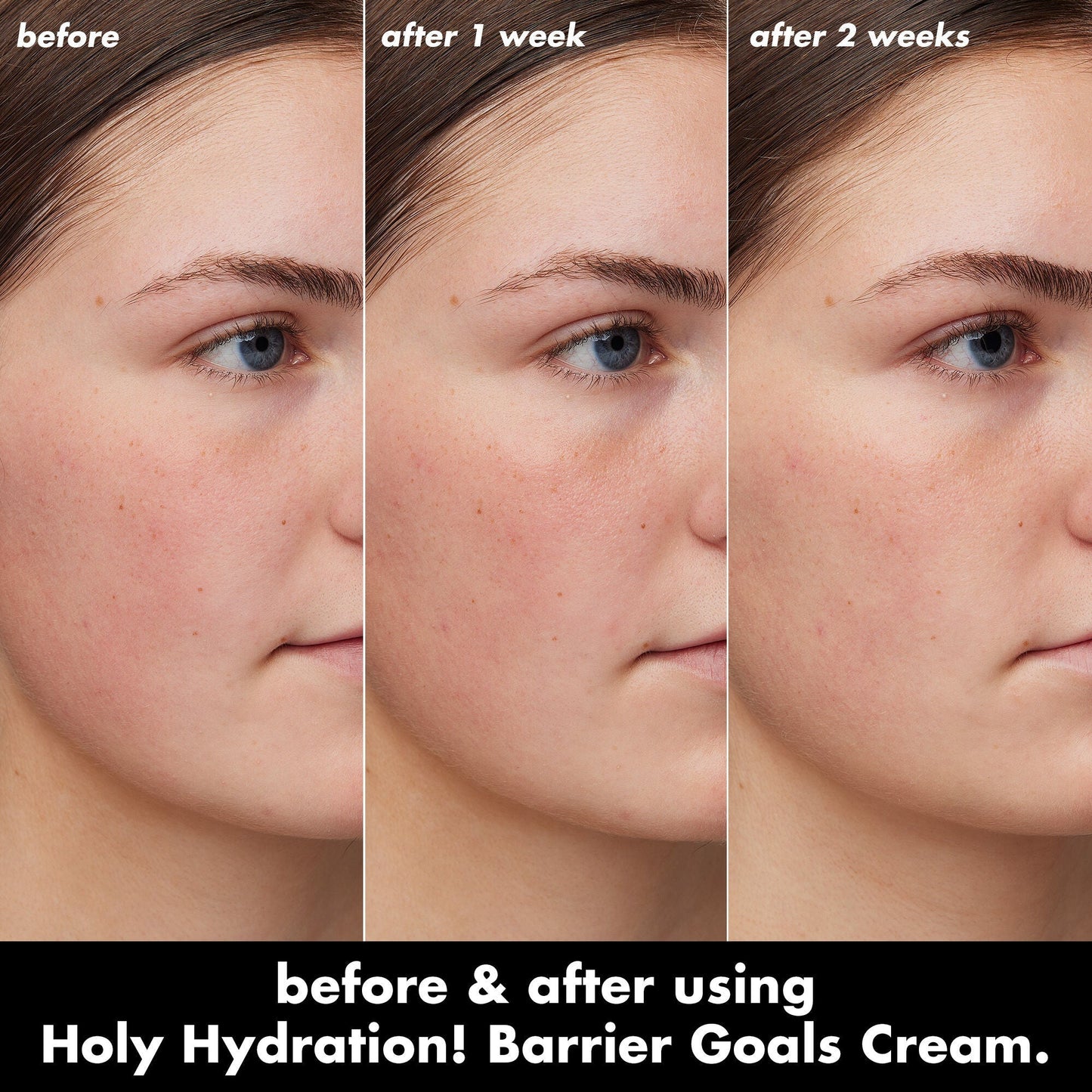 holy-hydration-barrier-goals-cream-mini-b8 0226_EDU_HHBarrierGoalsCream_B_A_Zoe_TRYPTICH_4f0e5b5d-35fb-4020-968e-244d4536afbd.jpg