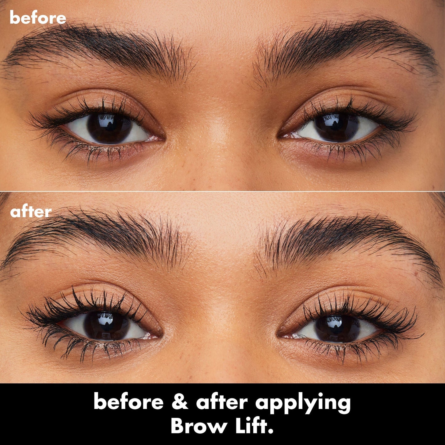 brow-lift-h3 0326_EDU_BrowLift_BA.jpg
