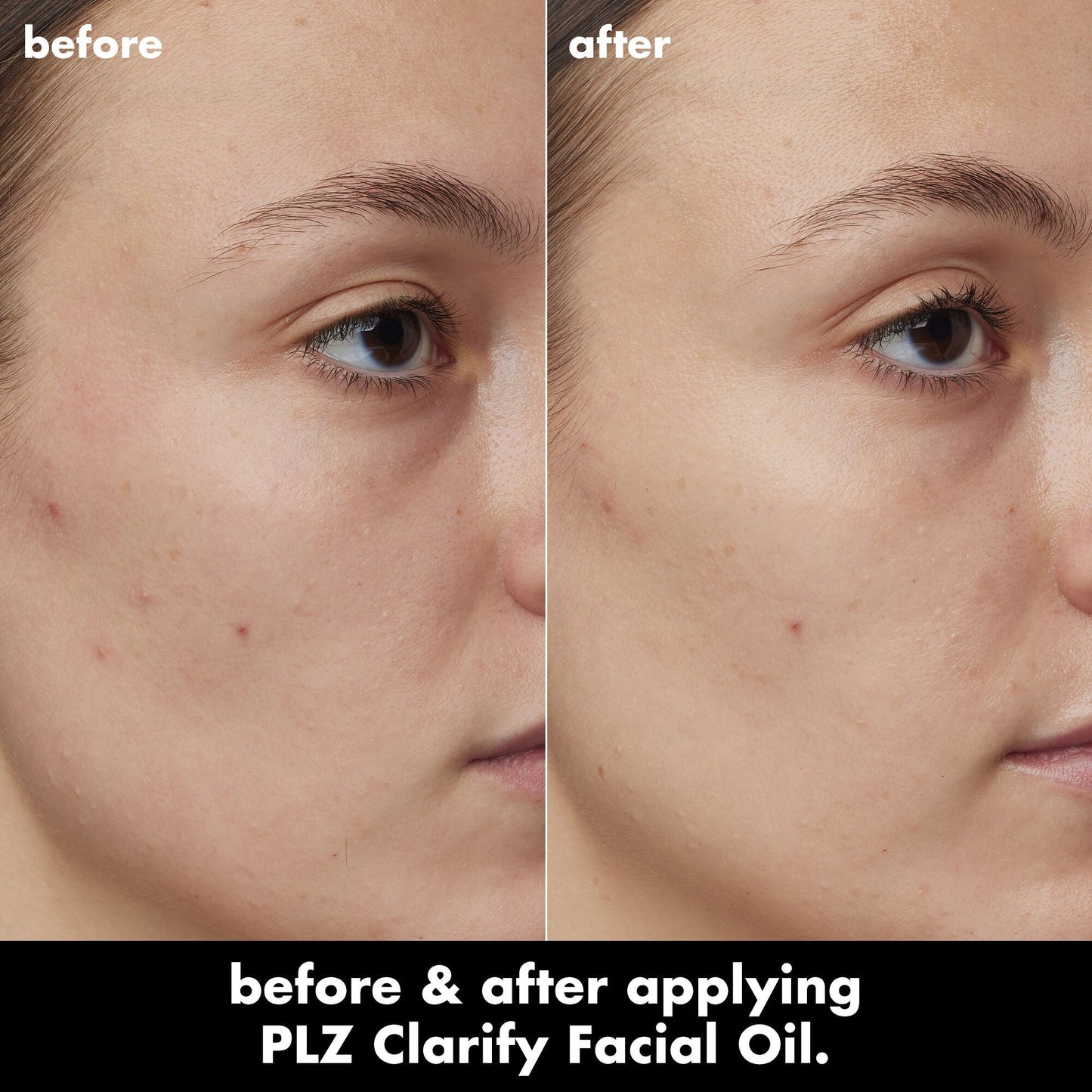 plz-clarify-facial-oil-u5 0326_EDU_PlzClarify_BA_Kelly.jpg