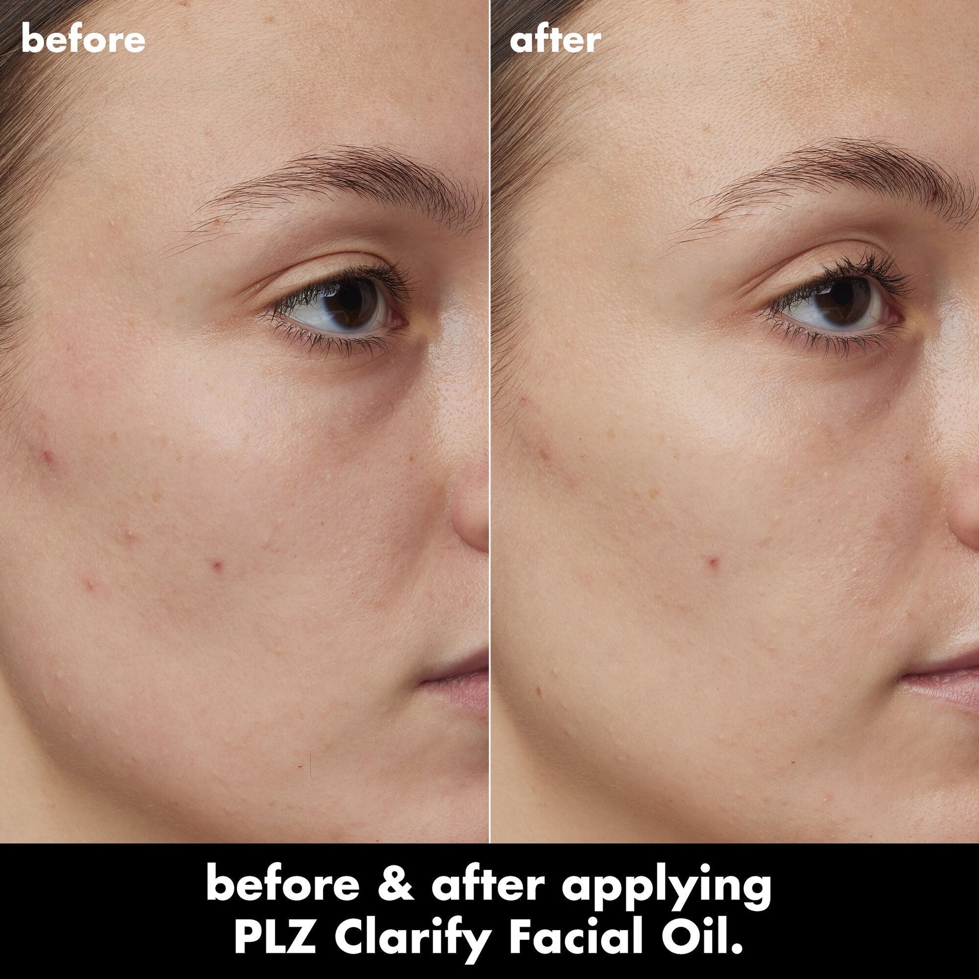 plz-clarify-facial-oil-u5 0326_EDU_PlzClarify_BA_Kelly.jpg