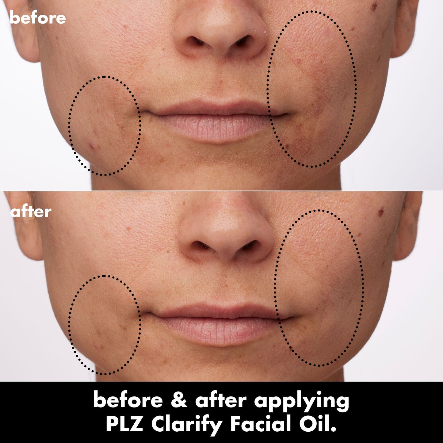 plz-clarify-facial-oil-u5 0326_EDU_PlzClarify_BA_Paula.jpg