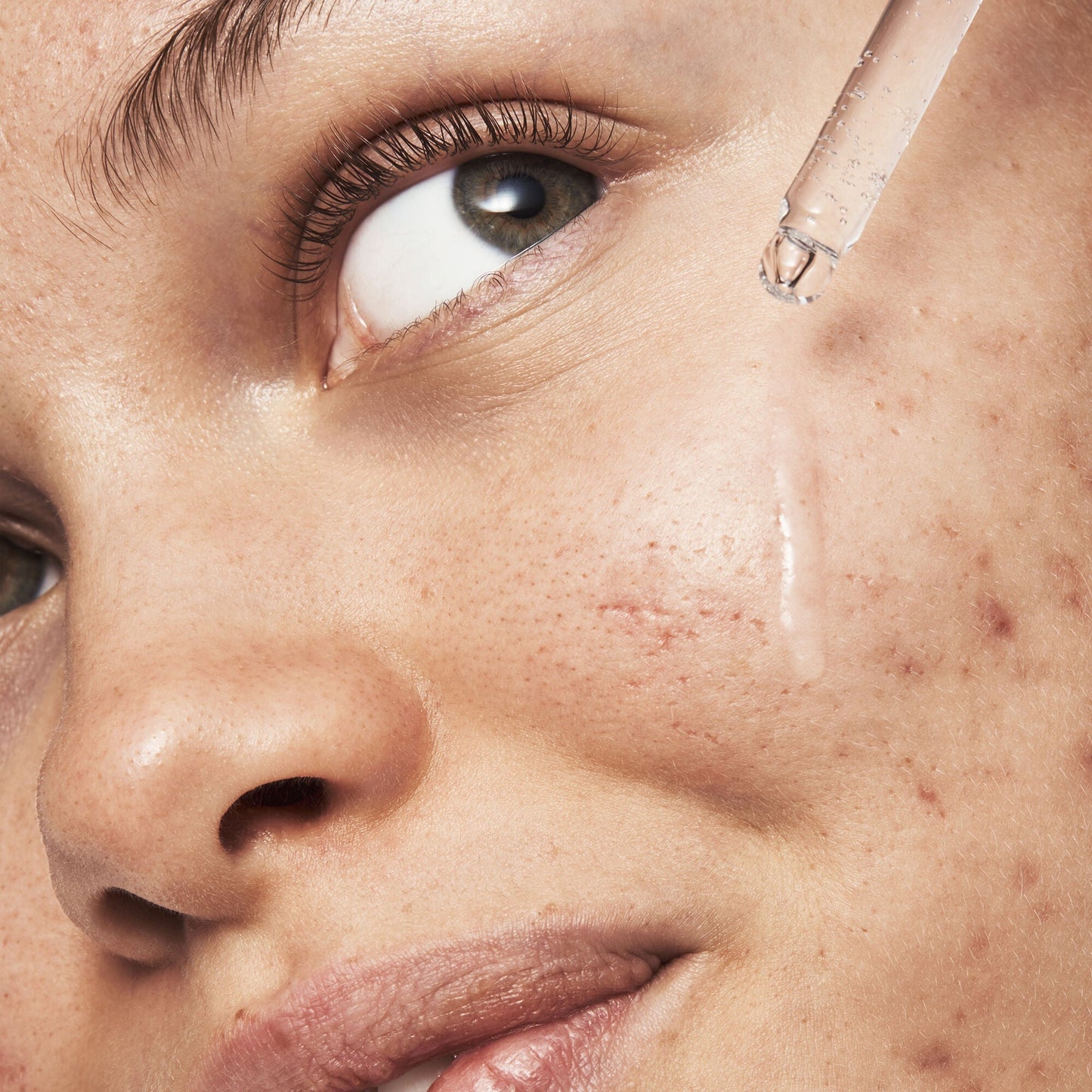 blemish-breakthrough-triple-acid-resurfacing-serum-q1 121321_Marley-Acne-Regimen_0254_FINAL_IGF.jpg