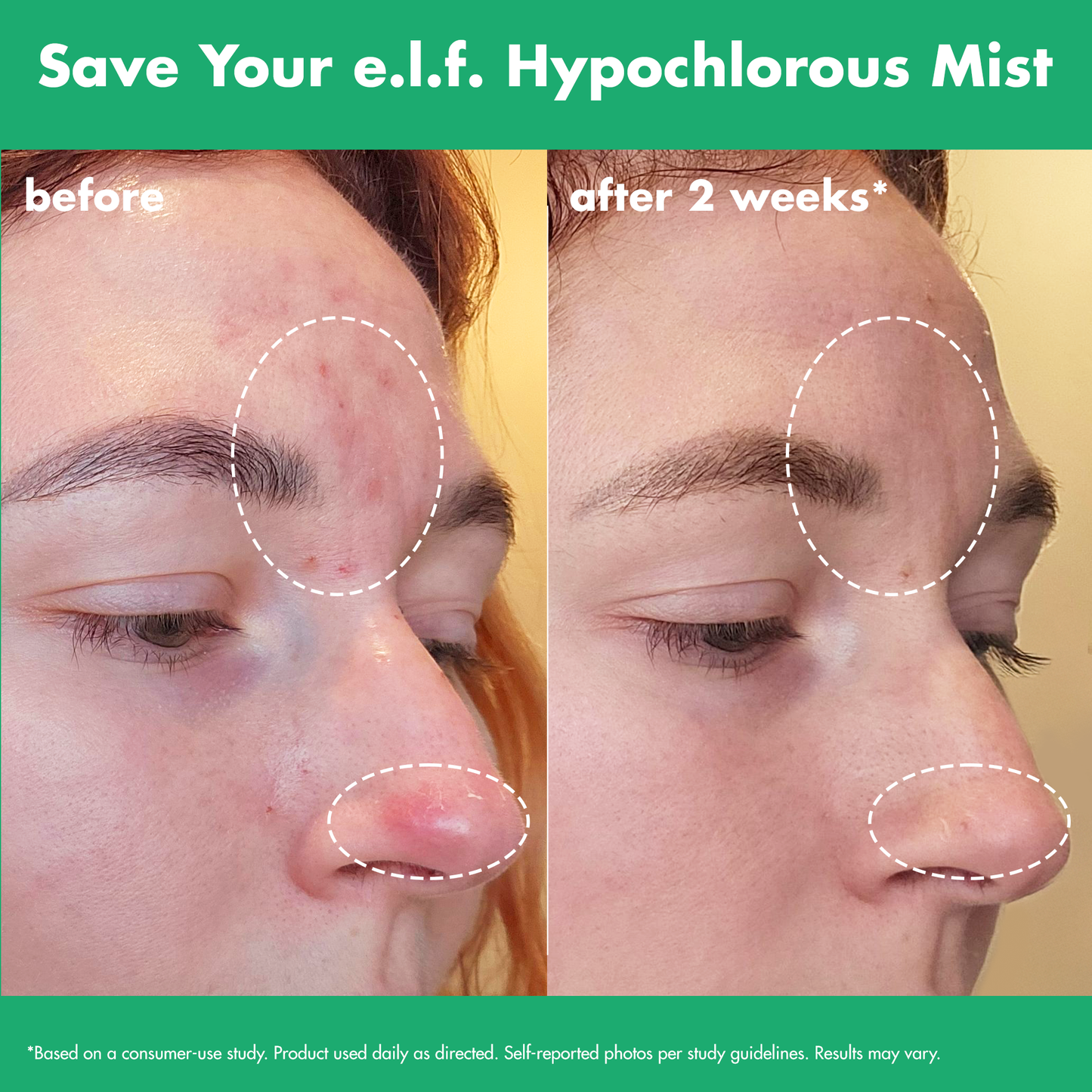 save-your-e-l-f-hypochlorous-mist-v6 FA26_EDUCATION_SAVEYOURELF_USAGE_BA1_WITHOUT_CLAIMS.png