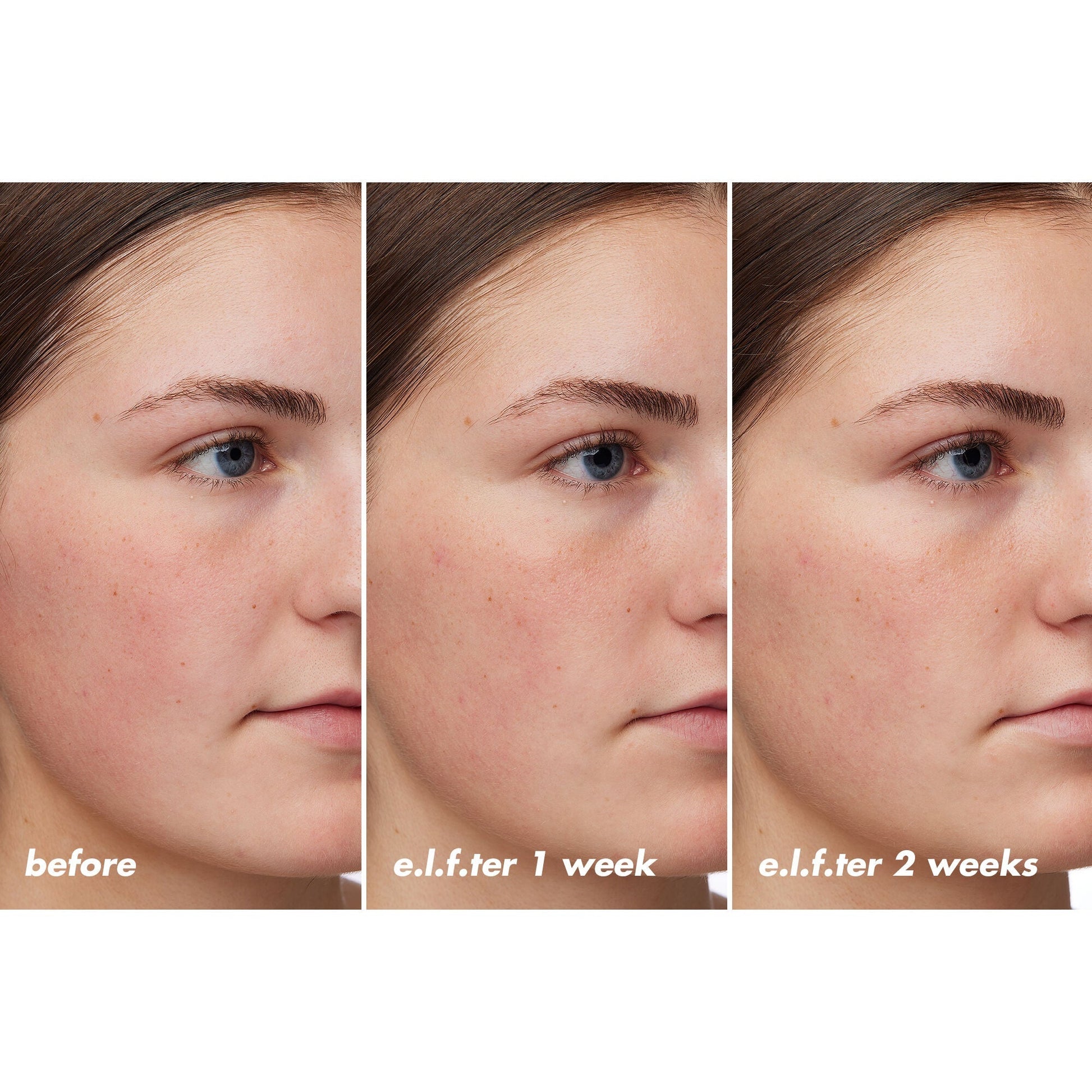 holy-hydration-barrier-goals-cream-regular-b5 XX26_EDUCATION_HH-BarrierGoals_B_A_Zoe_TRYPTICH_74c905bd-67bd-4b91-b633-2b01a8905cb8.jpg